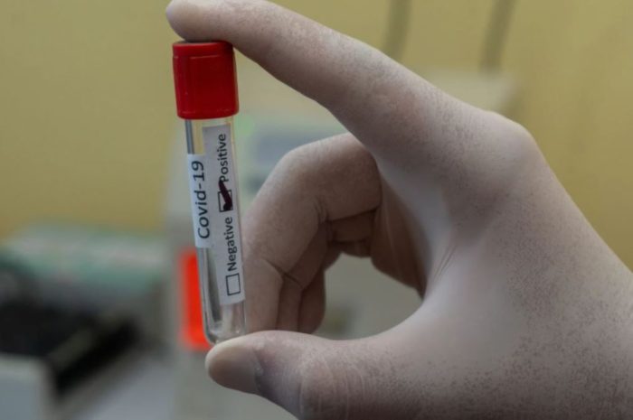 Coronavirus Testing Update – Nigeria to raise capacities